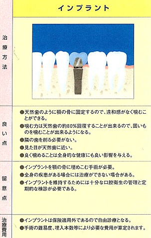 インプラント治療