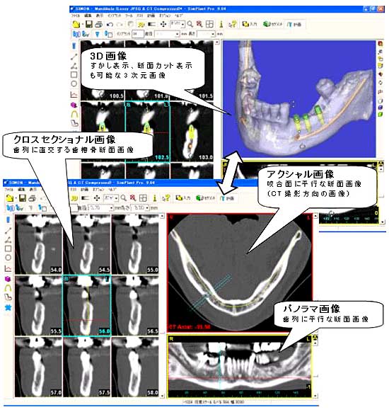 RD摜ff\tgiSimplantjP